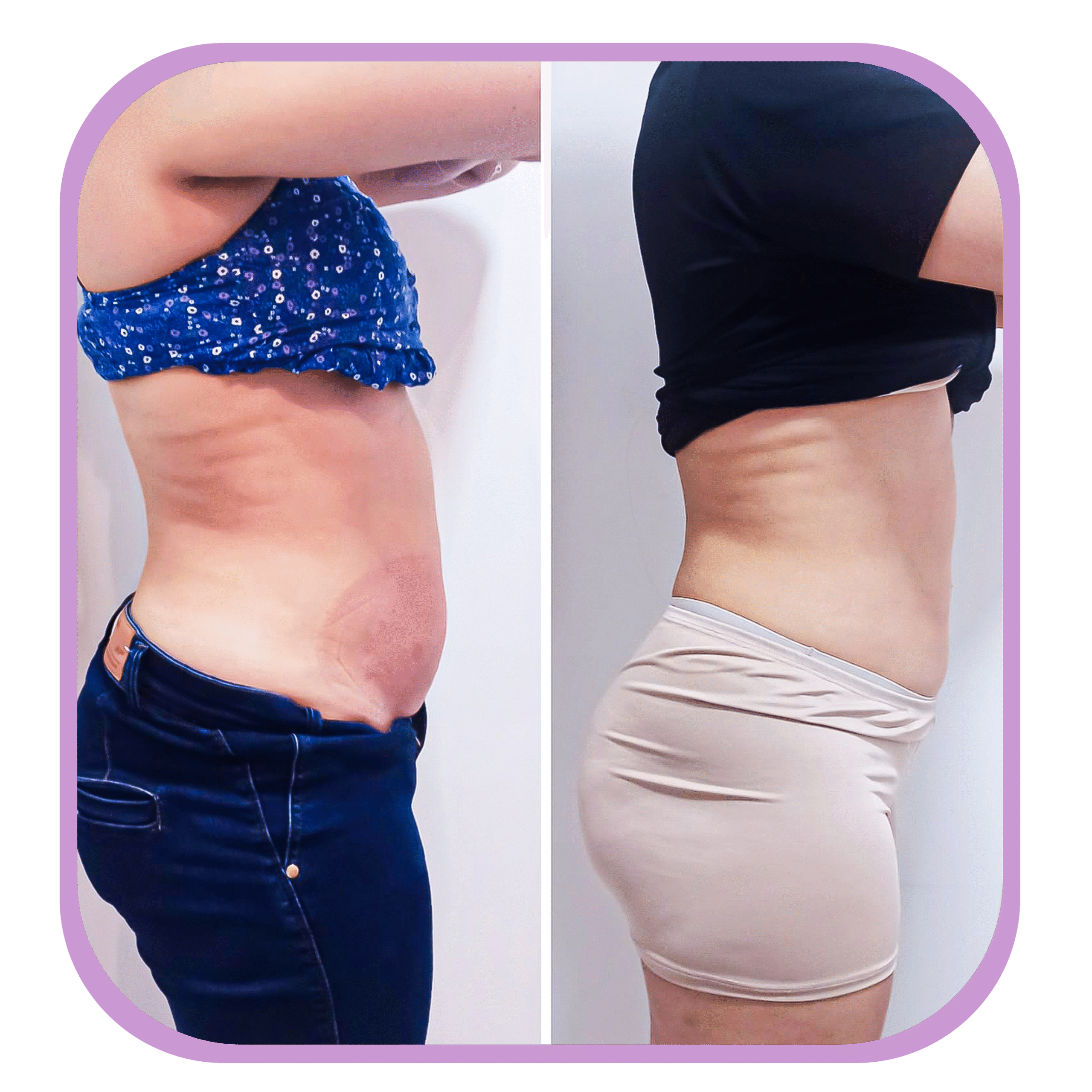 ANTES E DEPOIS - LIVMAIS - 1